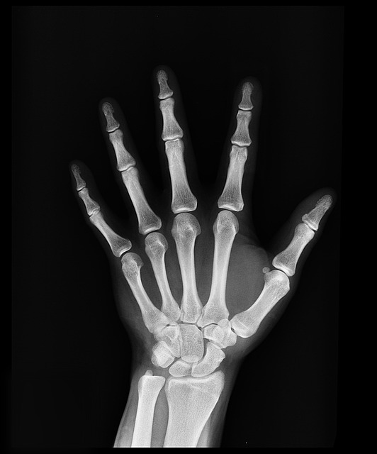 imagen de los huesos de una mano en fondo negro